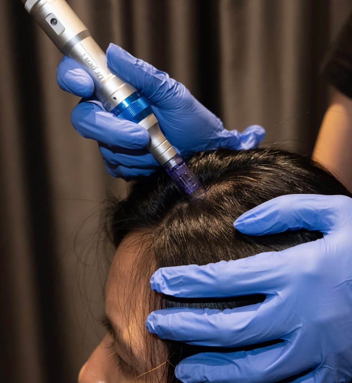 Hair Treatment with Derma Pen
