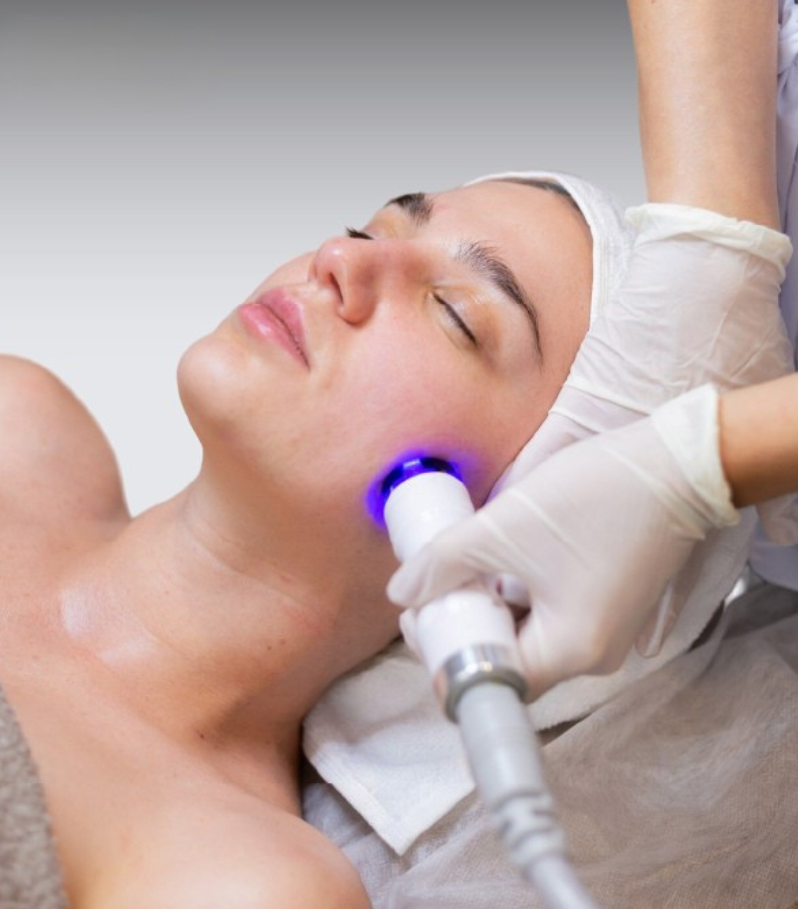 MNRF Scars Reduction